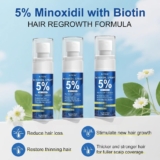 תפסו מהר לפני שיגמר! סט 3 בקבוקי Minoxidil ספריי מועשר בביוטין ושמן קיק רק ב₪31!